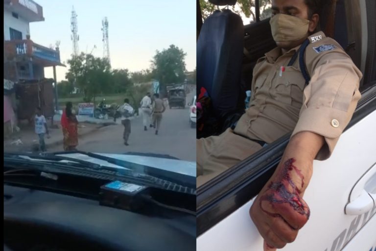 कोरोना कर्फ़्यू का पालन करवाने गए आरक्षकों और डायल 100 पर गाँववालों ने किया जानलेवा हमला